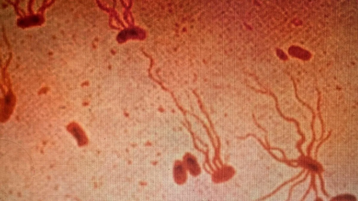 Antik Katil Geri Dönüyor: Antibiyotik Direnci Korkutuyor