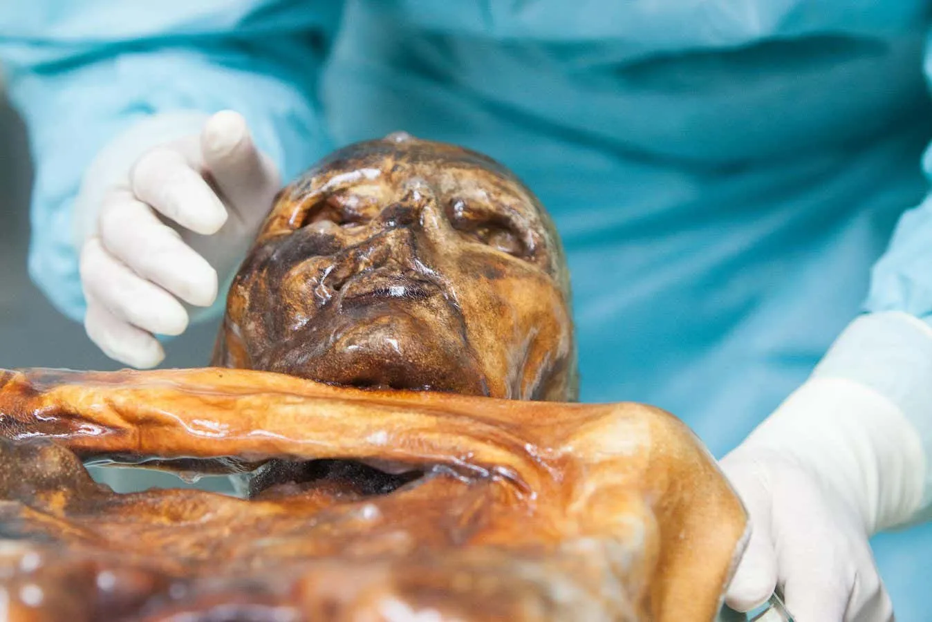 Ötzi'nin Donmuş Kalıntılarında Canlı Mikroplar Tespit Edildi